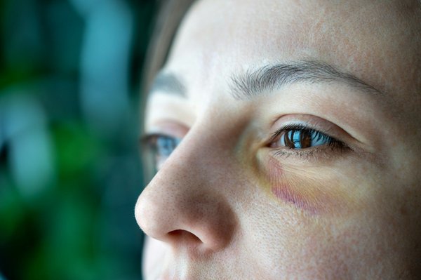 Traumatisme oculaire : causes et traitements